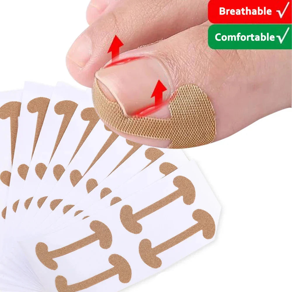 Toenail Correction Strips