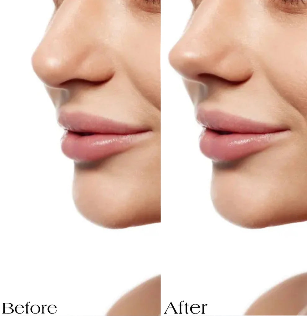 6Pc/Set Nose Shaping Insert